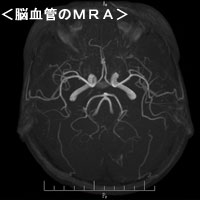 ＭＲＩ画像