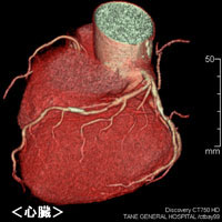 心臓CT画像